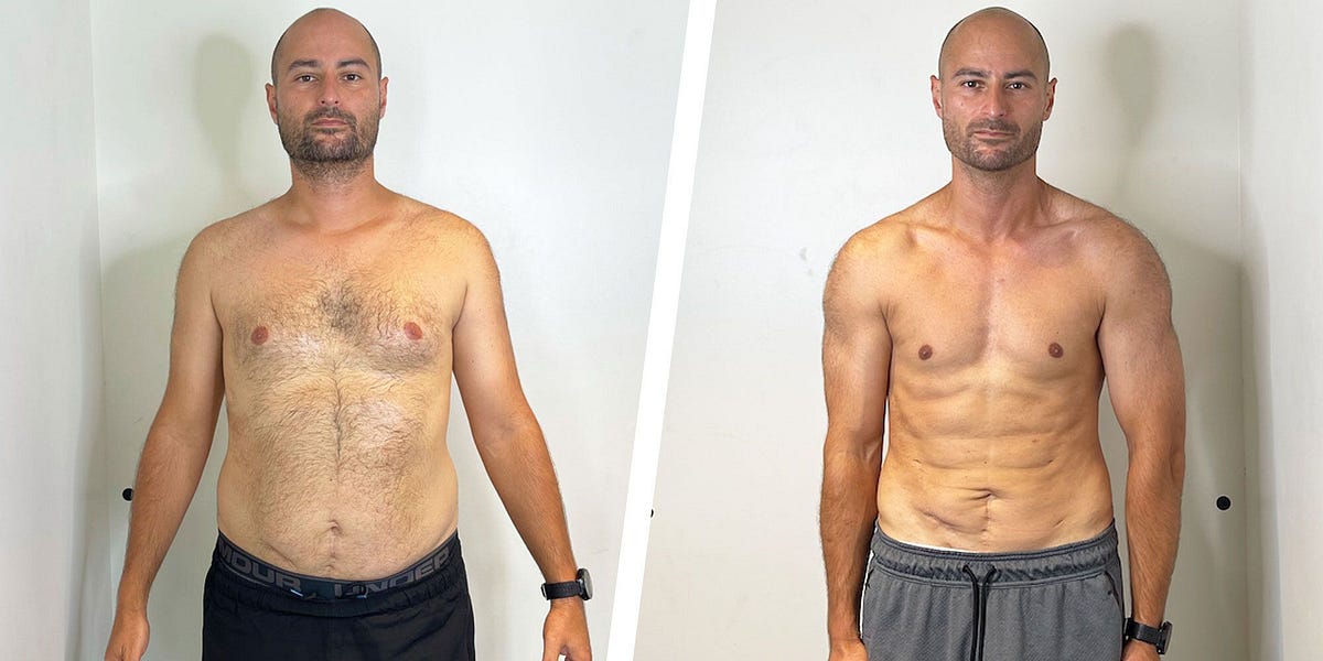 NEXA Retatrutide antes y después, resultado de pérdida de peso 3 (-20 kg · 100 días)